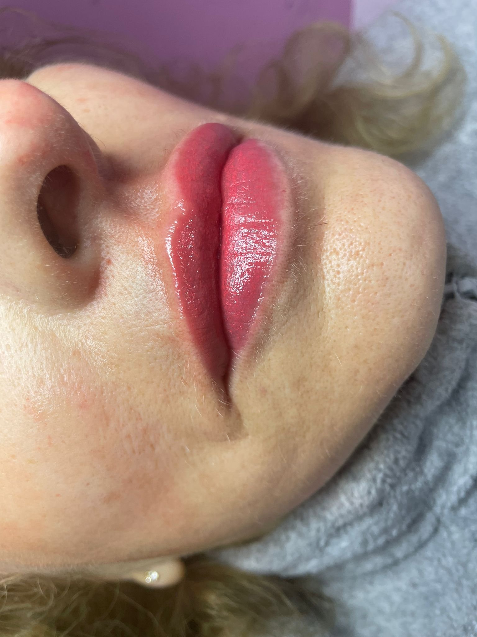 Tratamiento Estética 3